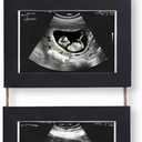 4-in-1 Sonogram Picture Frame, Display Pregnancy Keepsake Album for Pregnancy Announcements, Gender Reveal, and Newborn Photos, Perfect Gender-Neutral Nursery Decor, First Time Mom Gift, Black
