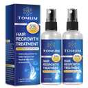 Minoxidil for Men and Women Hair Growth: 5% Minoxidil Topical Spray Hair Regrowth Treatment Stop Hair Thinning and Hair Loss For Stronger Thicker Longer Hair 60ml 2 Pack