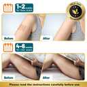 Arme Silicone Scar Tape, 1.6"x480" Silicone Scar Sheets(4 Rolls-12M) Medical Grade Scar Tape for Surgical Scars, Reusable Scar Patches, Professional Scar Removal Strips for C-Section Keloid Tummy Tuck