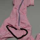 Yeapeeto Dog Onesie Surgery Recovery Suit for Large Medium Bodysuit Dogs Pajamas PJS Full Body for Shedding, Prevent Licking, Wound Protection, Cone Alternative (X-Large, Pink)