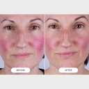 CurrentBody Skin LED Light Therapy Mask: Series 2
