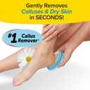 PedEgg Foot File Traps Shavings Inside for Mess-Free Use Painless Callus Remover with Ergonomic Handle for Tough, Dry Skin & Smooth, Soft Feet