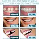 2 Pairs Temporary Smile Support Adjustable