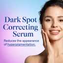 Differin Dark Spot Correcting Face Serum, Dark Spot Correcting Serum by the makers of Differin Gel, Gentle Skin Care for Acne Prone Sensitive Skin, 1 oz 