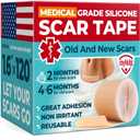 Medical Grade Silicone Scar Tape - 1.6x120 - Visible Difference on Surgical & Keloid Scars - Reusable Silicone Scar Sheets - Easy to Use Silicone Tape for Scars (Beige)