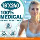 Arme Silicone Scar Tape, Silicone Scar Sheets (2 Rolls- 1.6" x 240"/6M)
