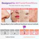 Blackhead Remover Vacuum, Pore Cleaner, Electric Remover Vacuum