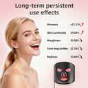 FSA Eligible LED Light Therapy Mask