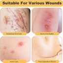 Hydrocolloid Bandages Roll for Wound Care, 2" x 16FT Self-Adhesive Dressing, High Absorbent Hydrocolloid Tape, Customizable Patch Size, Waterproof, First Aid Kit Essential