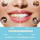 Teeth Whitening Strips Enamel Safe - 14 Treatments, Gently Remove Stains, No Sensitivity, Mint Fresh Breath, Vegan & Cruelty Free