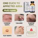 2 x "STAY STOKED" Wart Remover, Maximum Strength Wart Remover Freeze Off - Heavy-Duty Treatment for Stubborn Plantar Warts, Corns & Common Warts, Fast Results in 1-2 Weeks-H5516