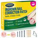 Small Size-Titanium Alloy Ingrown Toenail Treatment & Removal Kit for Quick Relief, Ingrown Toenail Removal Kit Professional Ingrown Toenail Corrector, Ingrown Toenail Tools for Quick Relief, 10 Pcs (0.45/0.51/0.55/0.59 Inch)