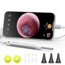 Anykit Digital Otoscope with Gyroscope, HD Ultra Clear View Ear Camera with Ear Wax Removal Tools, Video Ear Scope Otoscope with Light, Compatible with Android, iPhone 15 (Silver)