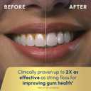Waterpik Cordless Advanced 2.0 Water Flosser For Teeth, Gums, Braces, Dental Care With Travel Bag and 4 Tips, ADA Accepted, Rechargeable, Portable, and Waterproof, Gray WP-587