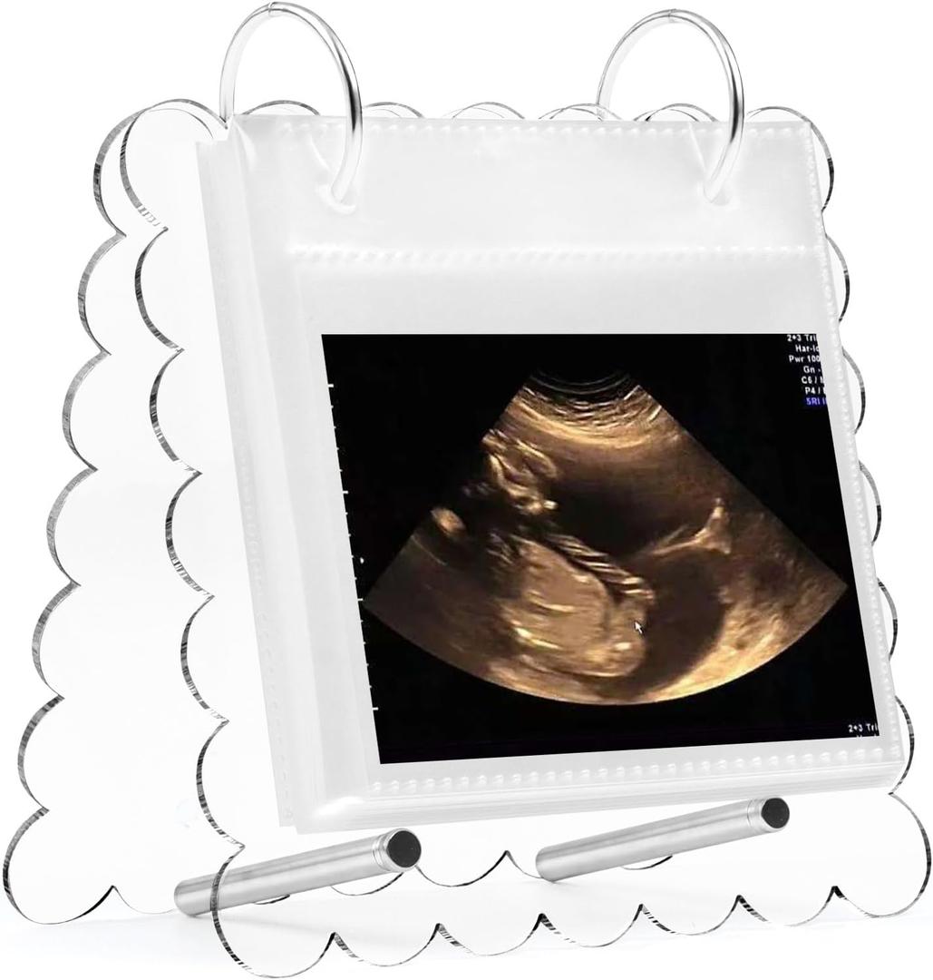 Flip Ultrasound Photo Album with Stand, Refillable Flip-Through Display for 3x4 Pictures, Acrylic Scalloped Cover, Pregnancy Gift for New Parents (Small)