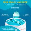 2 x Under Eye Patches 30 Pairs Hydrating Gel Masks with Collagen, Retinol & Albizia Bark | Helps Reduce Fine Lines, Wrinkles, Dark Circles, Puffiness & Eye Bags