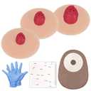 MedEduQuest Sticky Ileostomy Simulators, Stoma Training Model Set, Multi-Skin Tone Ostomy Care Practice Models for Medical Training and Patient Education - Light