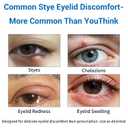 Stye Eye Treatment Product, Relief for Styes, Chalazions, Blepharitis, Dry Eyes, Irritation and Swelling; Clear Eyes Redness Relief, Eye Stye Treatment, Soothing Eyelid Comfort, 30ml 1 Fl Oz