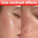 HKY Cooling Instant Soothing Facial Mask - Skin care Redness Relieving Deep Hydrating Pore Tightening with Zinc PCA, Botanical Peony, CoQ10, For Repair Skin Barrier(1 Box 12 Count)