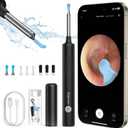 Ear Wax Removal, Ear Cleaner with Camera, Wireless Intelligent Visual Ear Picker, Earwax Removal Tool, 1080P HD Otoscope with 6 LED Lights, Ear Cleaner for iOS & Android (Black)