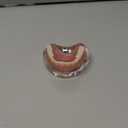 Dental Model Overdenture Inferior 2 Implants Demo Mandibular Model for Education and Study(Upper Jaw)