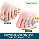 Povihome 10 Pack Pinky Toe Separator and Protectors for Overlapping Toe, Curled Pinky Toes - Spacers for Morton's Neuroma Pain Relief (Blue)