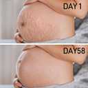 2 x PEGO Stretch Mark Oil for Pregnancy, Maternity Body Oil for Stretch Mark Prevention & Reduction, Hydrating Skin Care, 4.06oz (2Pack)