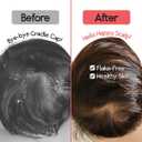 2 x SplashEZ Cradle Cap Brush for Babies | Soothing Newborn Head Massager | Food-Grade Soft Silicone Baby Bath Brush & Scalp Scrubber | Infant Cradle Cap Comb - Organic Shape & Ladybug Design, 2-Pack