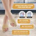 2PCS Bunion Corrector for Women & Men Big Toe Straightener-Bunions Correction Women & Men-Bunion Splint-Bunions Pads for Bunion Relief-Hallux Valgus Pain Relief,Comfortable & Breathable for Day/Night. (Beige)
