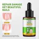 Ginger Nail Treatment, Ginger Cuticle Care Oil for Nails, Strengthen Nails, Ginger Nail Treatment Serum, Promote Nail Growth, Natural Plant Formula 30ml