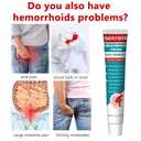 Hemorrhoid Care Cream - Relief for Pain, Itching, Burning & Swelling - Soothes Irritated Skin - 0.7oz (20g)