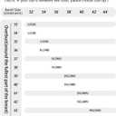 Padded No Underwire Bra Lace Wireless Back Smoothing Everyday Bras for Women Full Coverage (Black, XL)