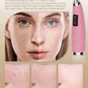 Pore Vacuum Blackhead Remover - Pore Extractor with 5 Attachments & 3 Suction Levels - Blackhead Remover Tools for Women and Men (Pink)