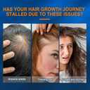 Minoxidil Hair Serum spray for Men and Women, 5% Minoxidil Hair Serumpromotes hair growth, makes hair and beard thicker and fuller (60ml)