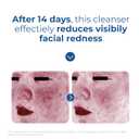 EltaMD Skin Recovery Amino Acid Foaming Facial Cleanser, Gentle Face Cleanser for Sensitive Skin and Post-Procedure Skin