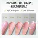 CHUCHU Nail Repair and Growth Serum: Natural Plant Strengthening Serum - Nail Cuticle Care for Women Men Home Salon Gift (Blueberry 02)