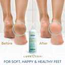 Callus Remover for Feet (Extra Strength) Foot Callus Remover Gel - Pedicure Tools for Feet Scrubber Foot Care Spa Essentials, 6oz