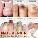 2 Pack Fungal Nail Patches 42 Pcs - Nail Repair Patches with 9-Hour Adhesion, for Discolored & Damaged Toenails Care, Overnight Renewal for Men & Women（2 packs with 21 patches each)