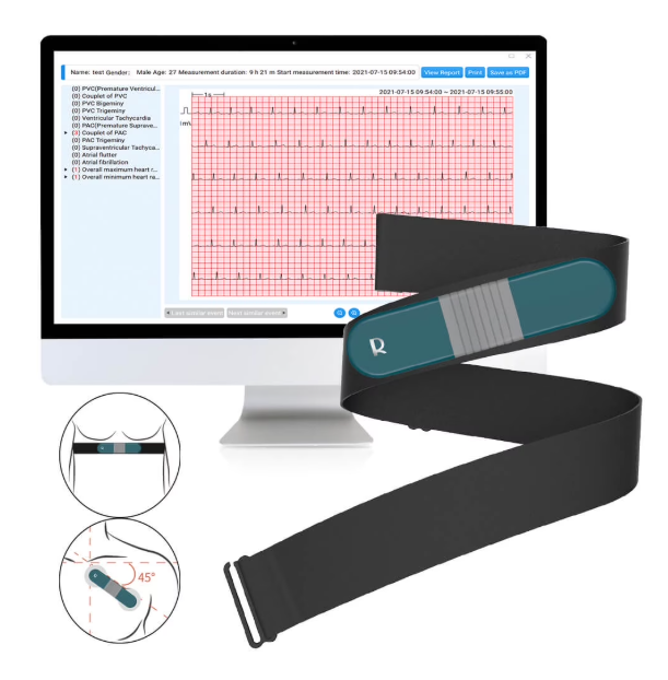 Checkme Livenpace HHM1 Heart Rate Monitor, ECG/EKG Machine for Athletes, Designed for Training Use
