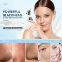 Blackhead Remover Pore Vacuum, Upgraded Black Head Remover for Face, Electric Acne Comedone Whitehead Extractor Tools-5 Suction Power, USB Rechargeable Pimple Popper Tool Kit