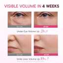 APBM Volufiline Plumping Serum for Face | 5% Volufiline + 3% Niacinamide + 1% Multi-Peptide | Visible Volume for Under-Eye & Smile Lines | For Fuller, Radiant-Looking Skin, Boost Collagen | 1.01 fl oz