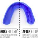 SISU 3D Mouthguard - 2.0mm Thin - Pre-Formed for Custom-Molded Fit - Remoldable Up to 20 Times - Non Toxic (Adult (over 5' tall))
