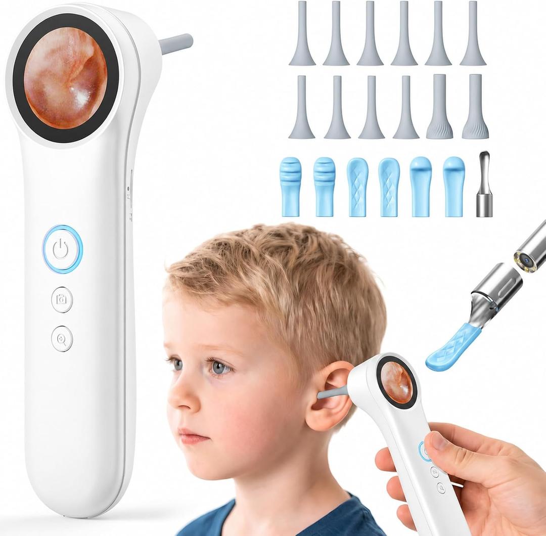 Ear Camera with 1.21 Screen, 1080P HD Digital Otoscope Ear Scope with 4 LED Lights, Ear Cleaner Camera with 10 Ear & Nose Tips, 6 Ear Pick Tools, Skin Probe, Type-C Charging for Adults Kids Pets