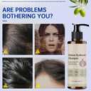 Onion Shampoo and Conditioner Set with Biotin & Rosemary – Onion Extract Formula Strengthens Hair, Reduces Breakage, Improves Texture & Shine, for All Hair Types (3.38 fl oz Each)