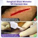 1 Pack 3ml Veterinary Surgical Skin Glue with 10 Applicators, Strong Surgical Adhesive, Blue-Tinted Fast-Acting Tissue Wound Glue, Up to 30 Applications, Ideal for Multi-Pet Households