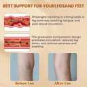 2 Pairs Compression Stockings for Women & Men, 20-30mmHg Thigh High Compression Socks, Open Toe Medical Compression Socks with Silicone Dot Band for Sport Swelling Varicose Veins