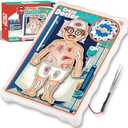 Operate Board Game for Kids Ages 3-8–Fine Motor Skill Toy with Vibration–Educational Hands-On Activity for Boys and Girls–Interactive Family Game for 1 or More Players–Gift for Christmas, Birthdays