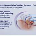 Colgate Sensitive Prevent and Repair Toothpaste, 6 Ounce
