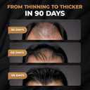 SPARTAN Root Activator Shampoo For Men - Hair Growth Shampoo for Hair Loss and Thinning Hair, 6.8fl oz