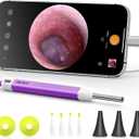 Anykit Digital Otoscope with Gyroscope, HD Ultra Clear View Ear Camera with Ear Wax Removal Tools, Video Ear Scope Otoscope with Light, Compatible with Android, iPhone 15 (Purple)